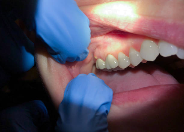 Best After-Hours Emergency Dentist in South Charleston, WV